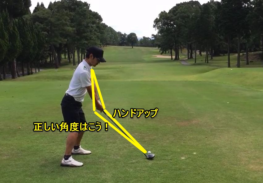トゥダウンの対策は？